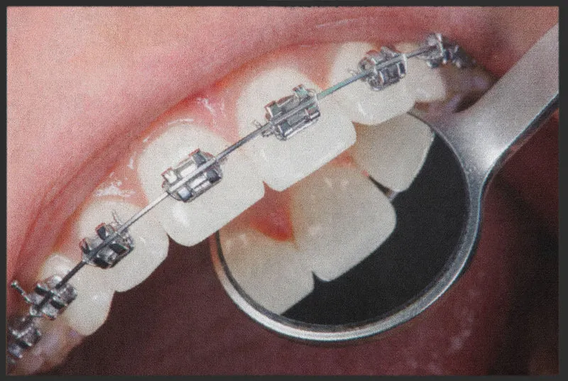 Fussmatte Kieferorthopäde 6146